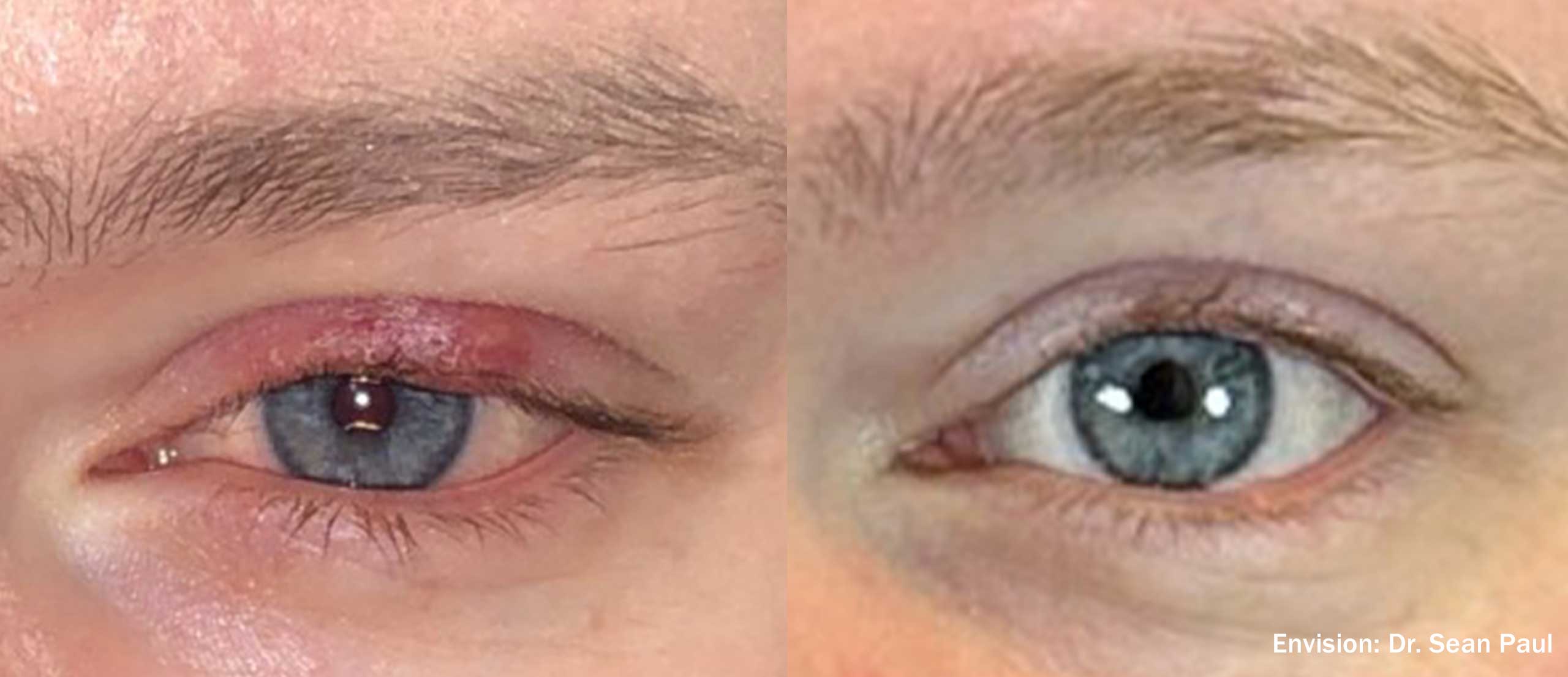 Forma I before and after — full face